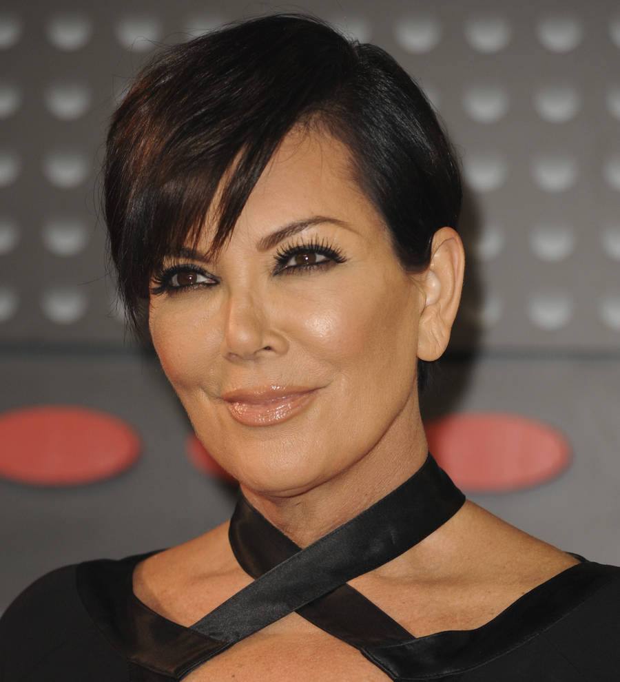 Kris Jenner pulls out of TV appearance after allergic reaction
