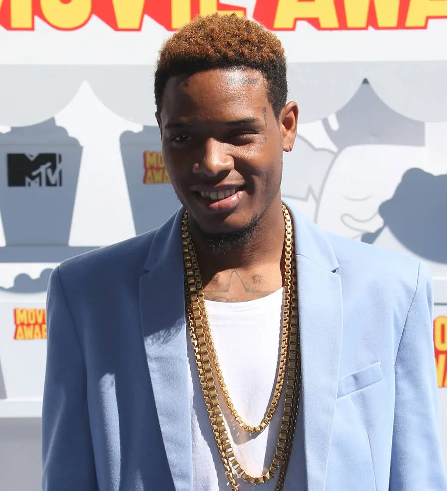 Fetty Wap's leg broken in three places