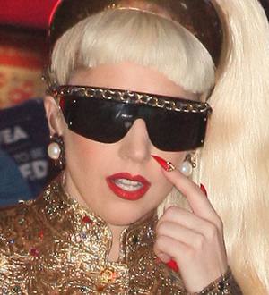 Lady Gaga shows off bruises after pole mishap