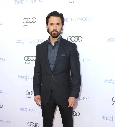 Milo Ventimiglia worked hard to fix his 'crooked mouth'
