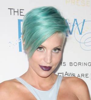 Model Lisa D'Amato has surgery to fix smashed face