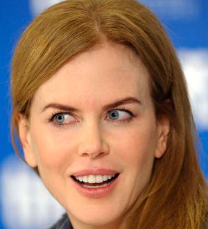 Nicole Kidman Sore From Moulin Rouge Knee Injury for Two Years