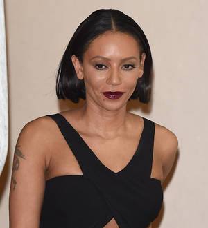 Melanie Brown delays eye surgery