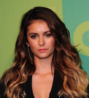 Nina Dobrev left with scar and permanent nerve damage after monkey bite
