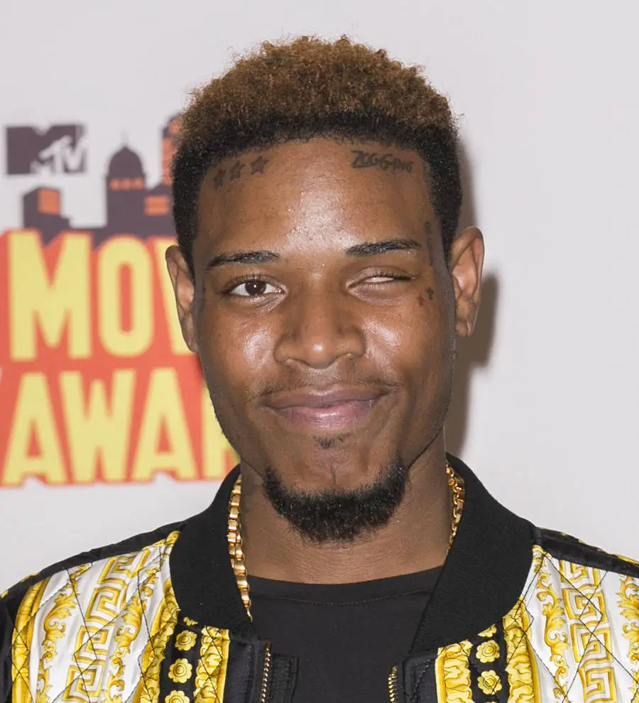 Fetty Wap injures leg in motorcycle accident