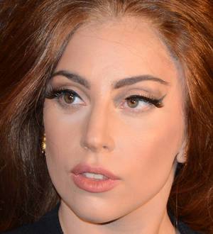 Lady Gaga recovering from hip surgery
