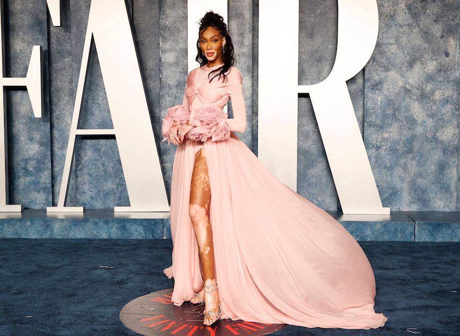5 Fashion Trends for Spring/Summer We Are Loving!