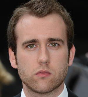 Harry Potter star was under contract not to fix his teeth