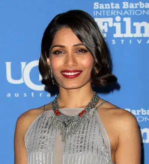 Freida Pinto feared concussion after bumping heads on Desert Dancer set