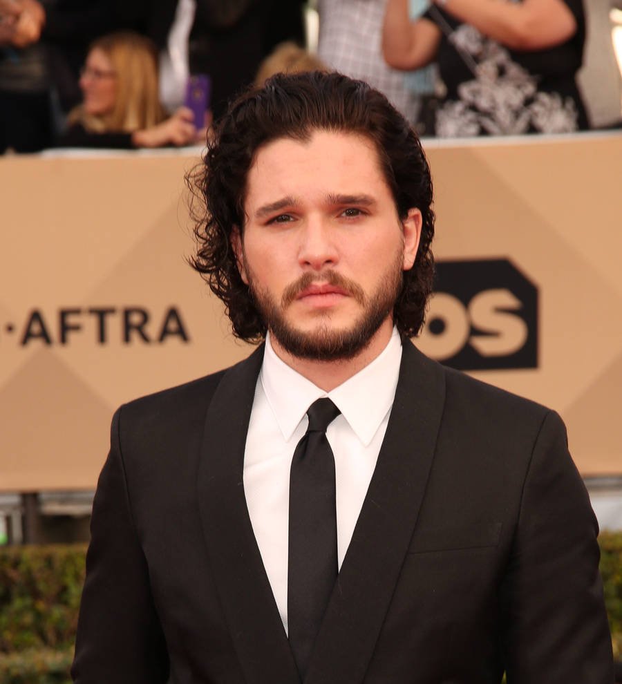 Kit Harington sported black eye for Game of Thrones audition