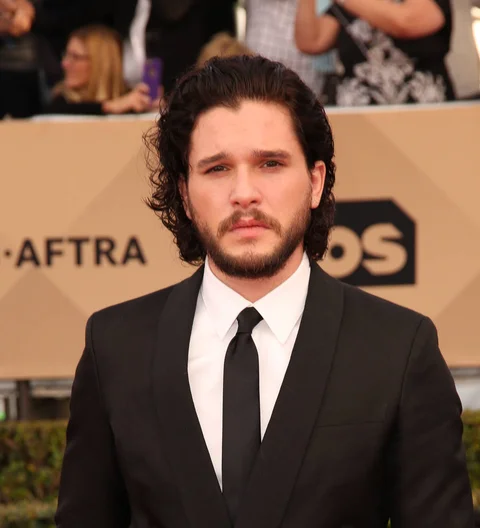 Kit Harington sported black eye for Game of Thrones audition