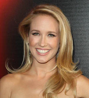 Anna Camp hospitalized with concussion during True Blood